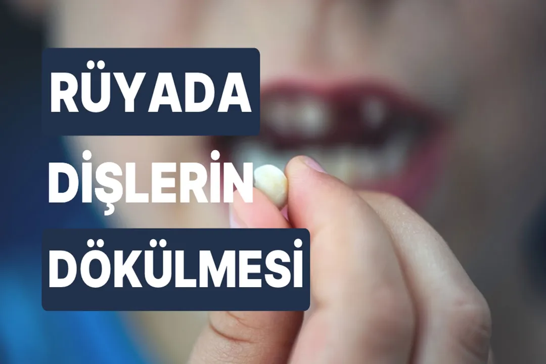 İslam'da rüyada diş dökülmesi, Tüm Dişler