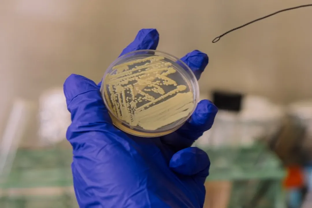 Did NASA discover a bacteria that can play dead?, Planetary Risk