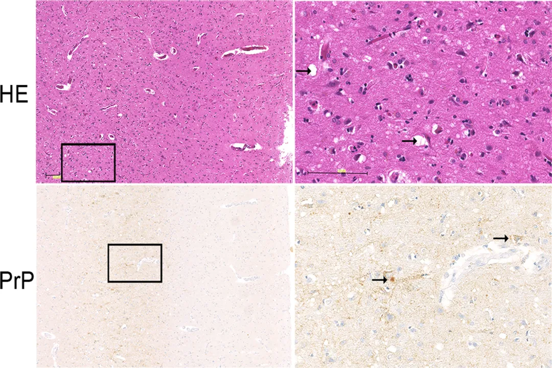 How do prions cause disease?, Conversion Mechanism