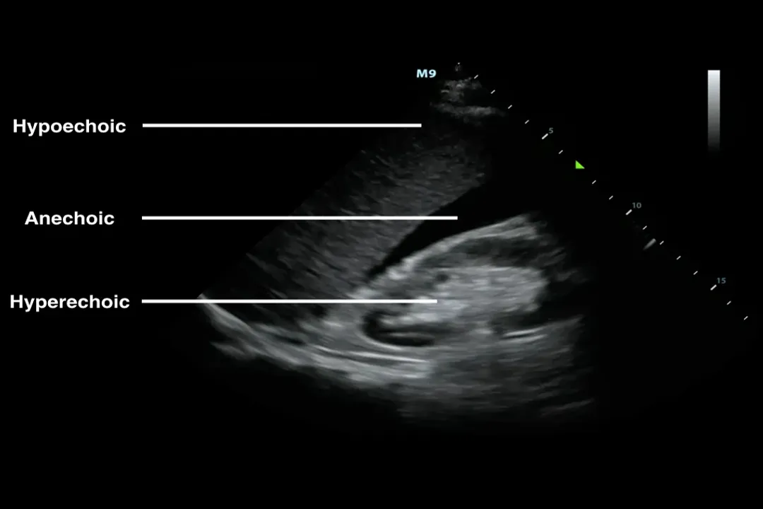 How does ultrasound imaging function?, Sound Frequencies