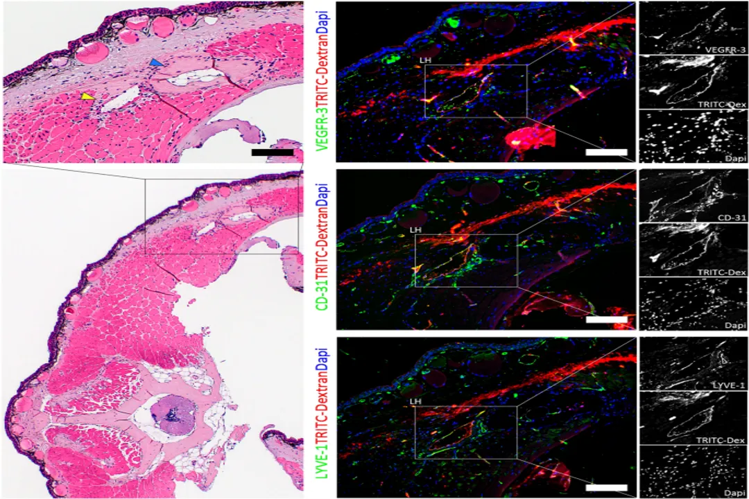 How many hearts does a newt have?, Cardiac Repair
