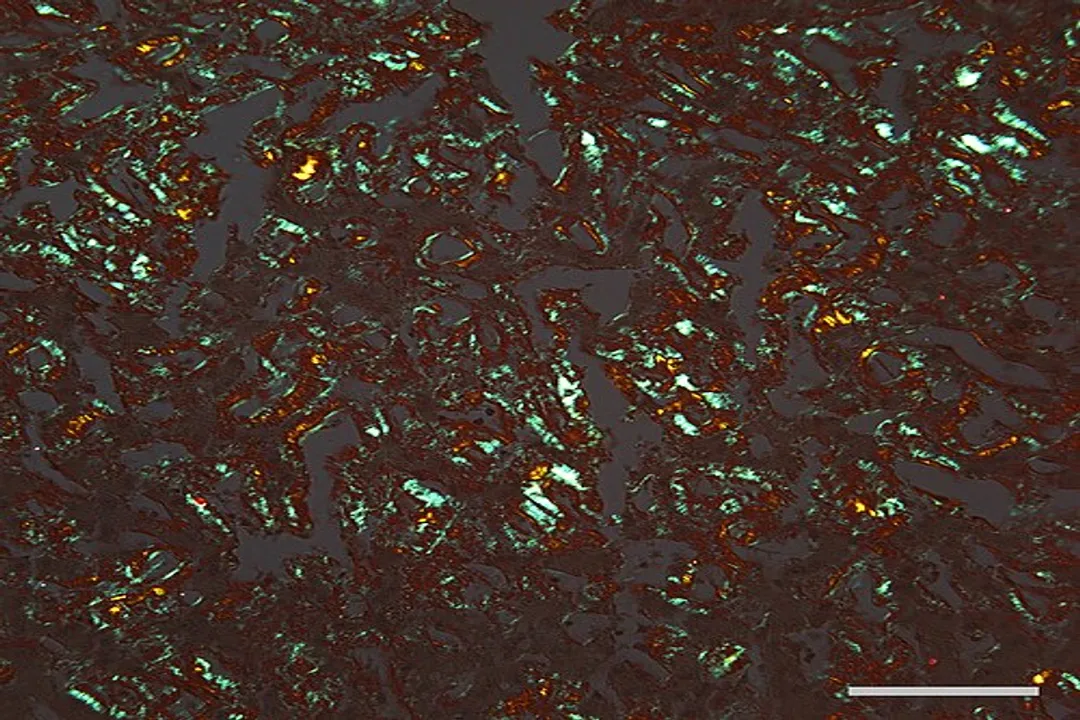 What causes protein misfolding diseases?, Toxic Intermediates