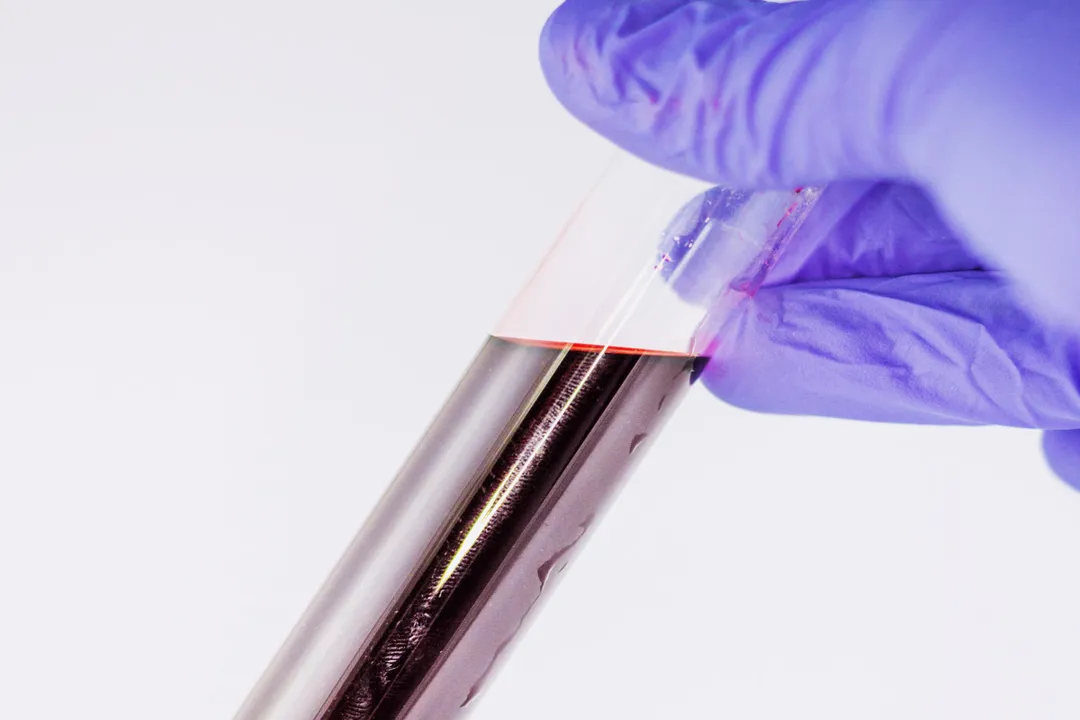 What color is blood in a vacuum?, Inherent Blood Color