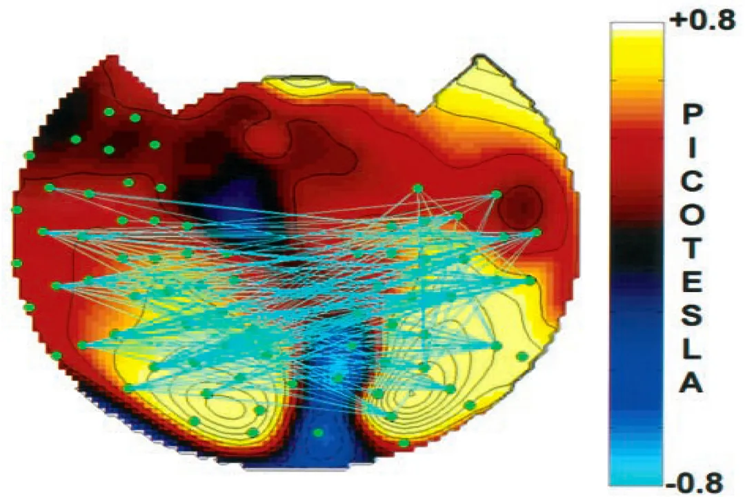 What mechanisms underlie consciousness?, Neural Dynamics
