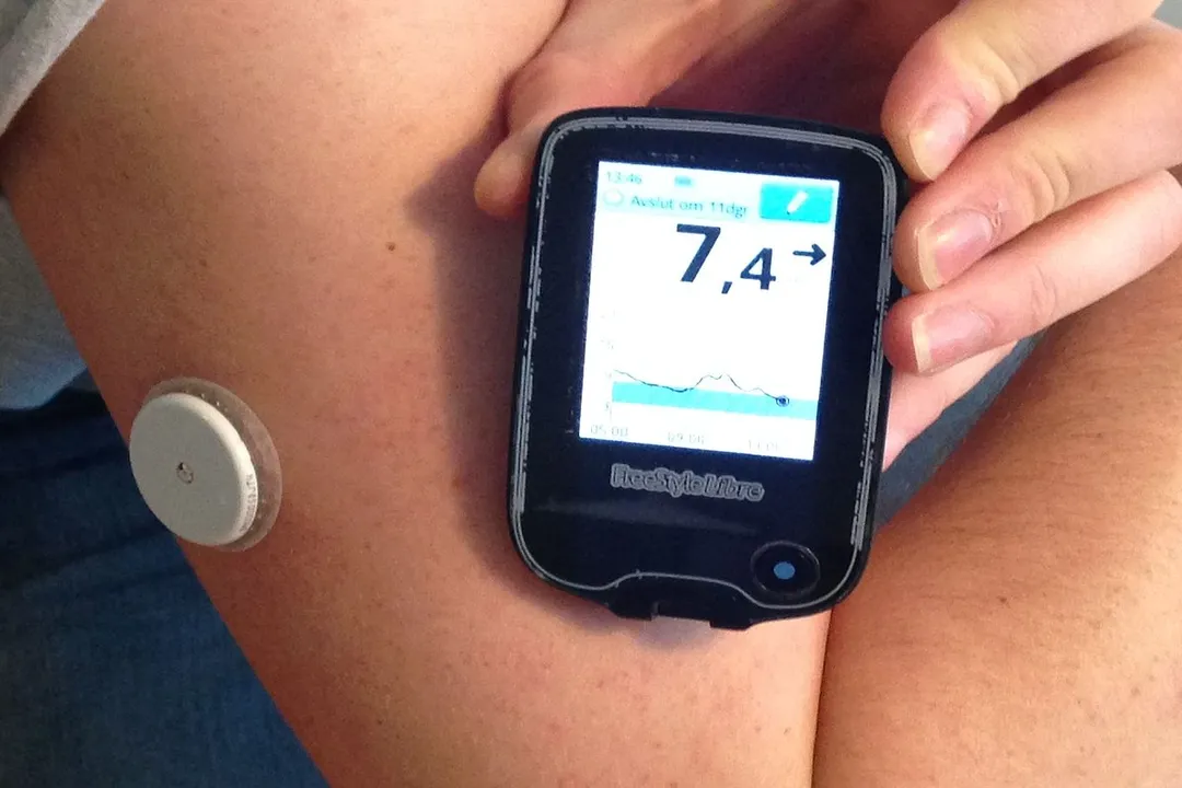 Who invented wearable glucose monitors?, Foundational Science