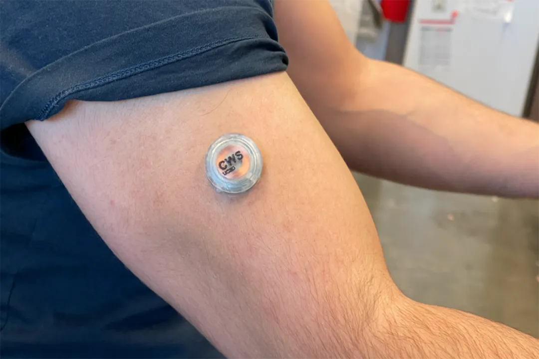 Who invented wearable glucose monitors?, Engineering Miniaturization