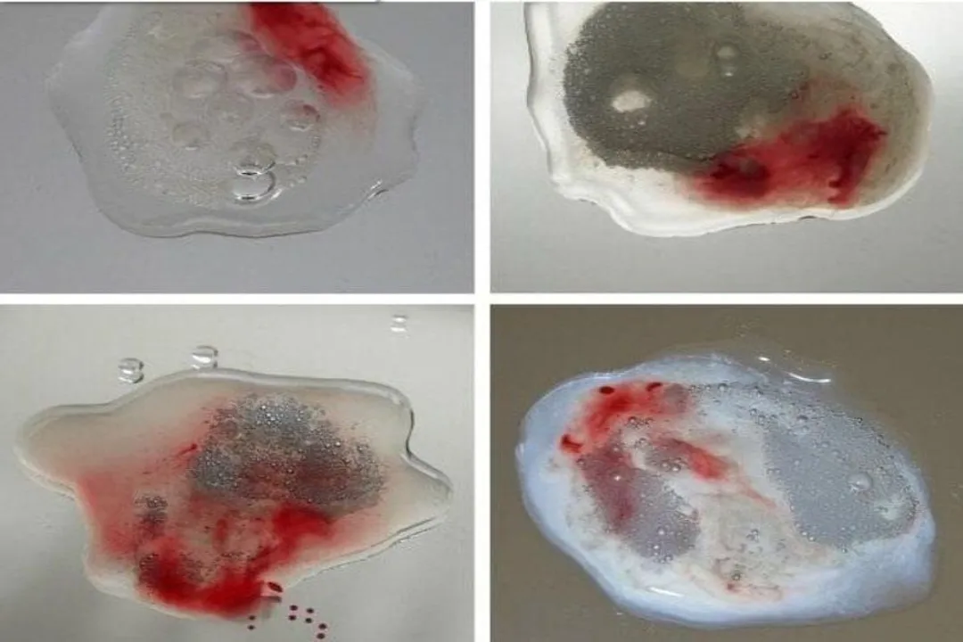 What are the cons of a vasectomy?