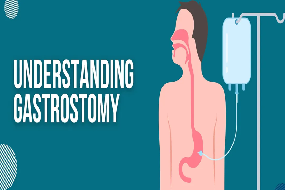 What does gastronomy mean in medical terms?