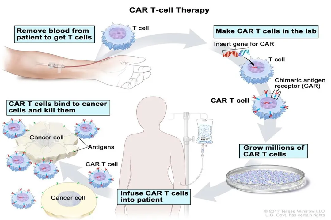 What is an example of T cell therapy?, Cell Transfer Concept