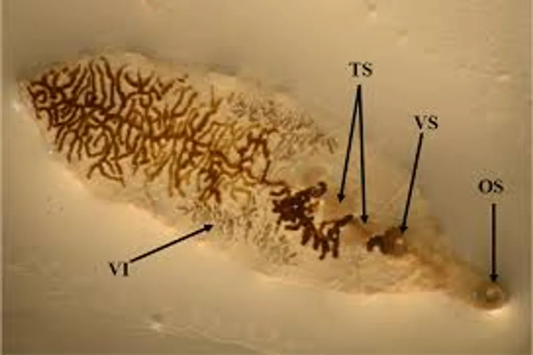 What is dicrocoeliasis?