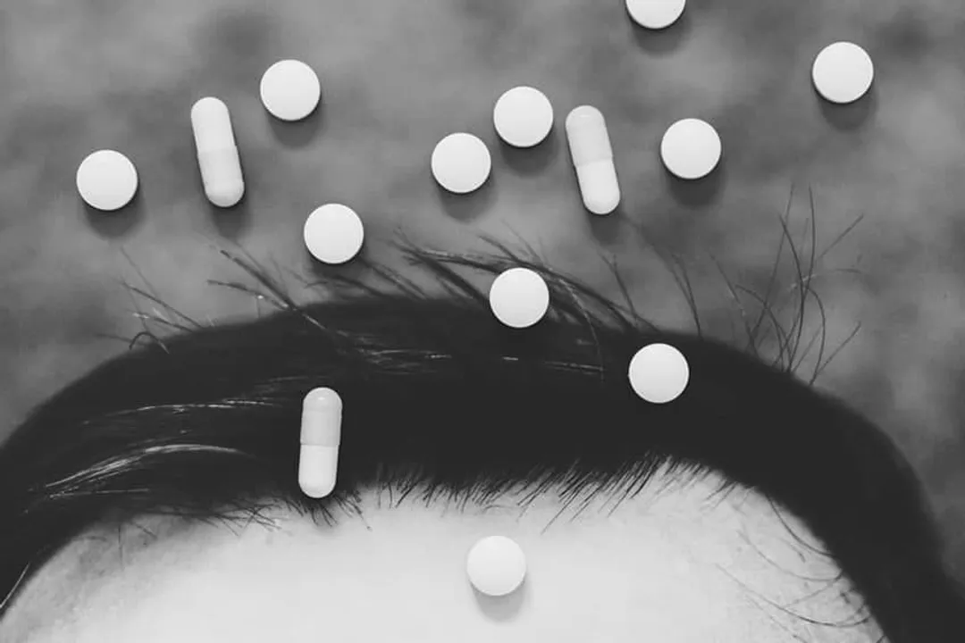 What is shock loss?, Hair Trauma