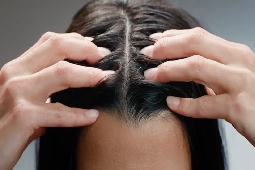 What is the main cause of hair loss?, Stress Response