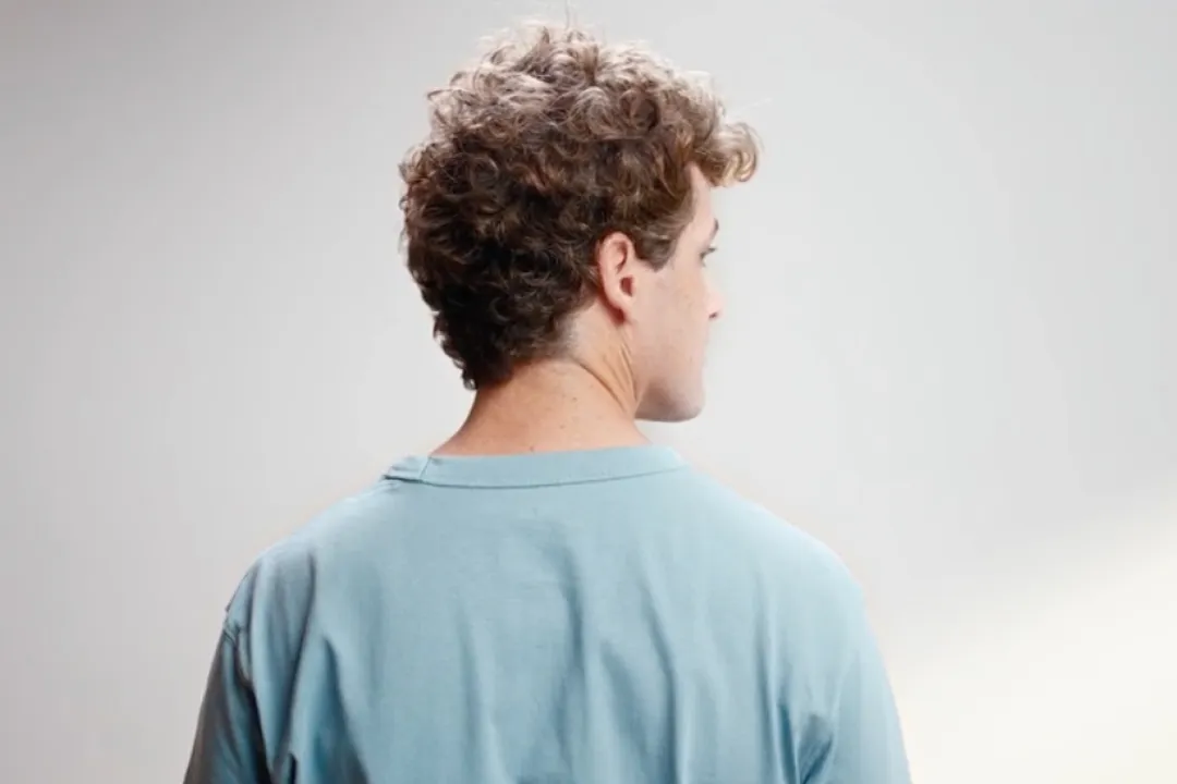 What is the main cause of hair loss?