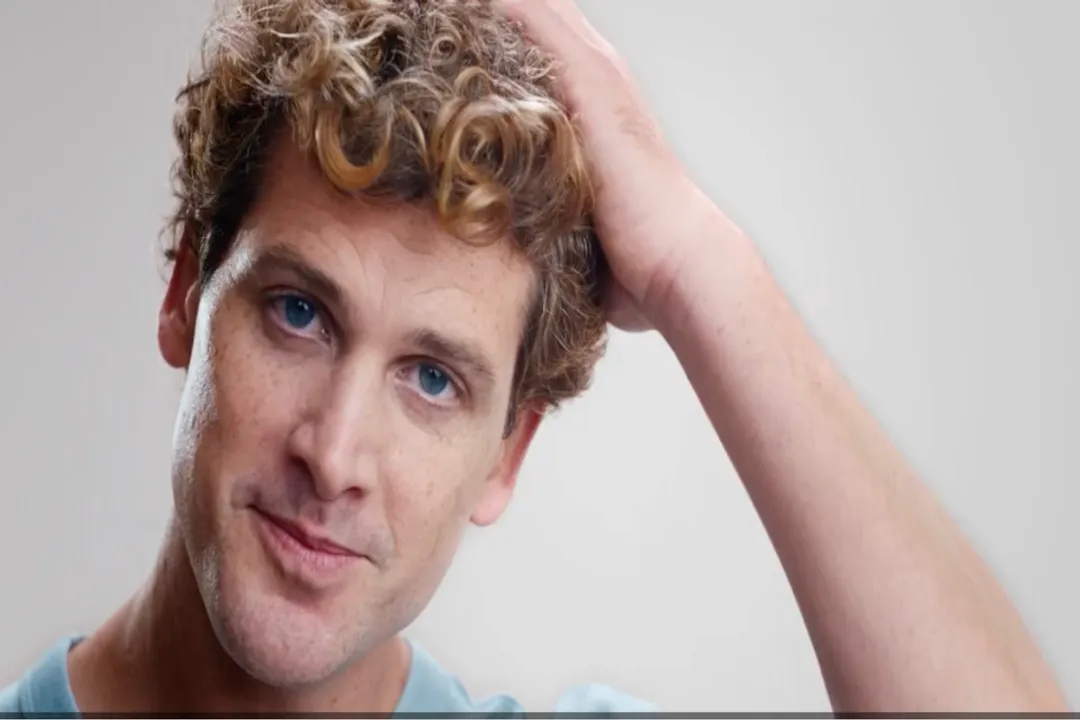 What is the main cause of hair loss?, Autoimmune Attack