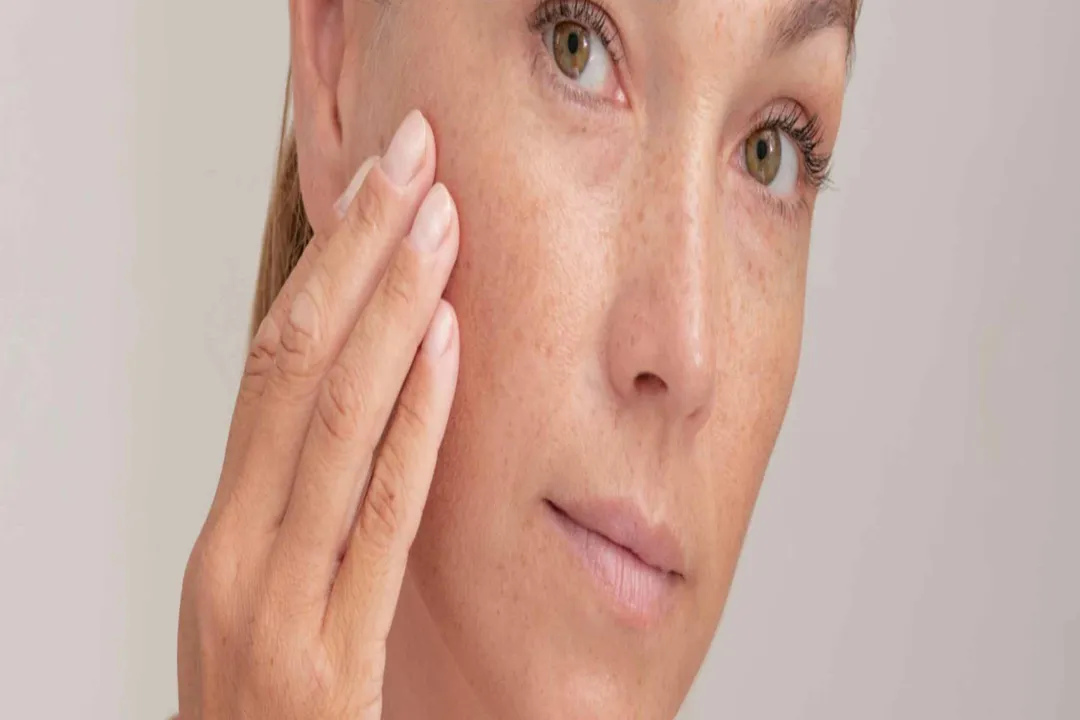 When should I be concerned about discoloration?, Common Forms