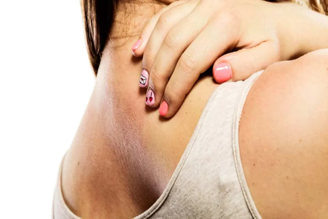 Why does my skin sting in salt water?, Osmotic Shock