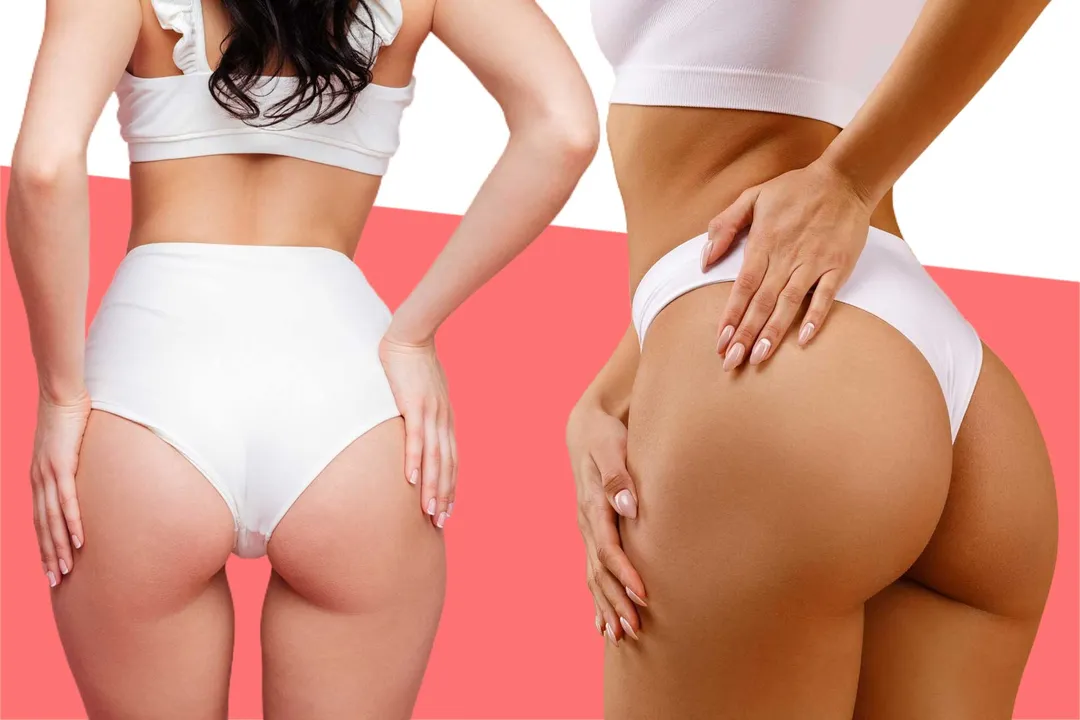 What does BBL mean for a girl?