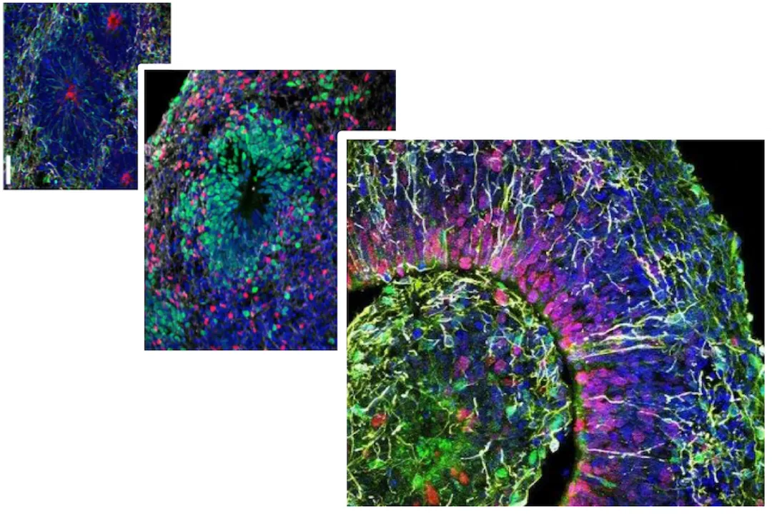 What is the best stem cell therapy for autism?, Research Context