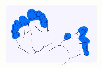 What is the life expectancy of blue babies?